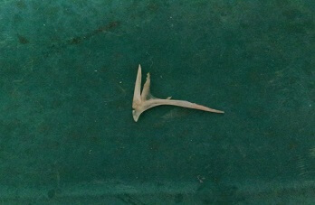 chicken-bone-nasopharynx